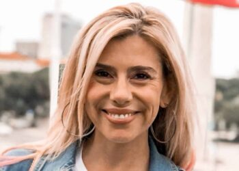Mónica Sintra faz cirurgia ao rosto: antes e depois